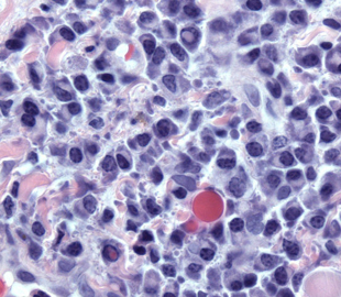 Structures within blood plasma called Dutcher and Russell Bodies